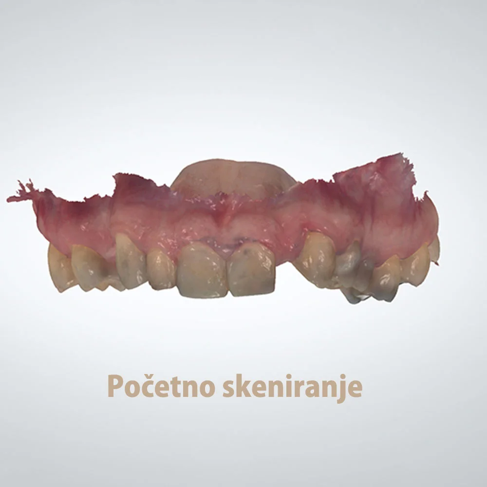 Digitalno skeniranje — status scan, Vogdent